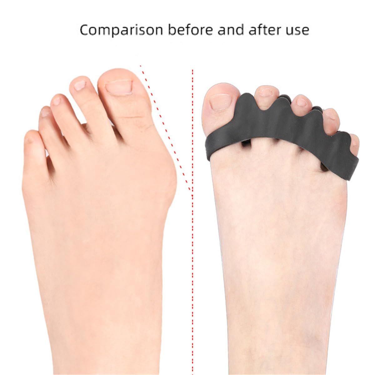 Роздільник для пальців і коректор кісточки великого пальця стопи для здоров'я пальців ніг, 2 пари, фото №6