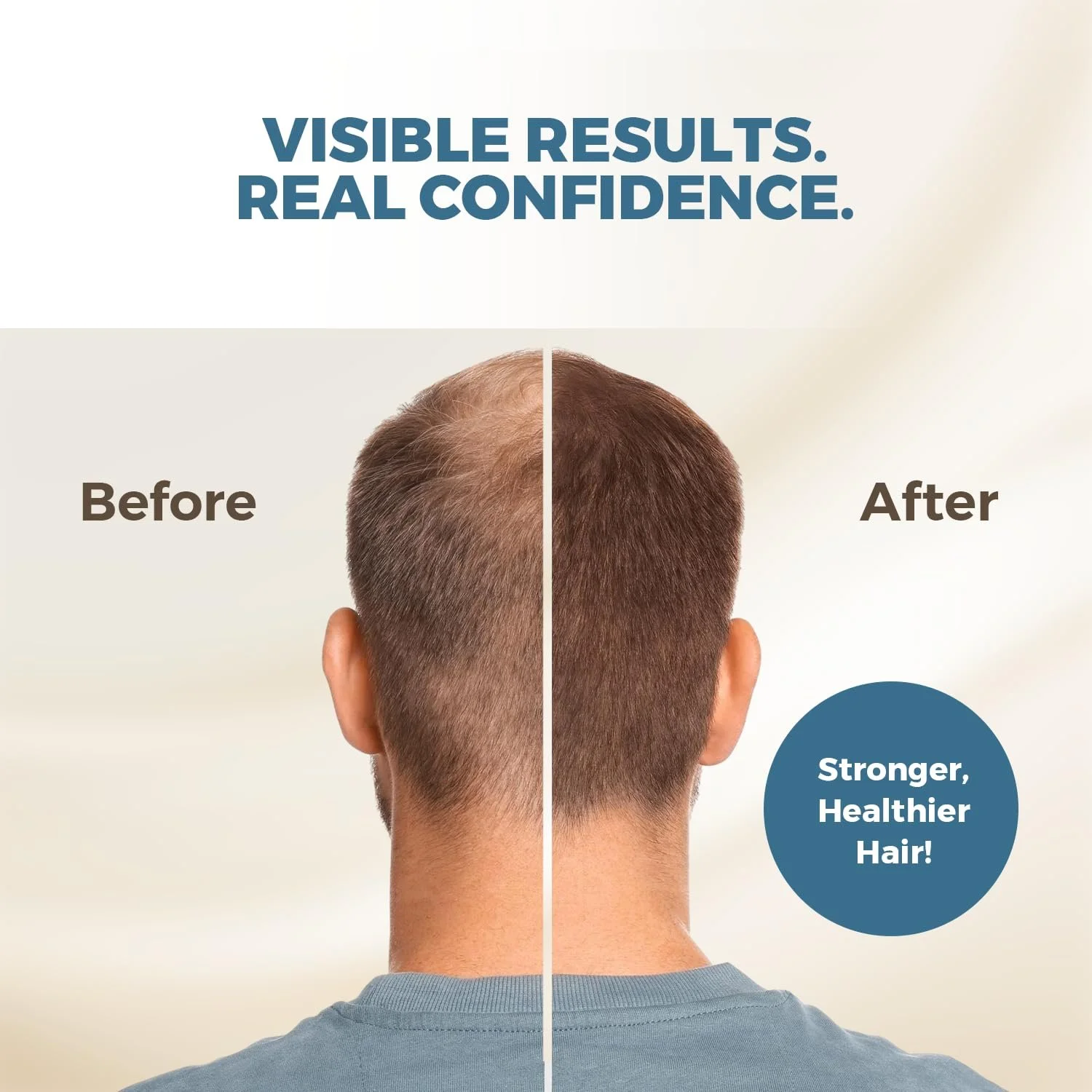 Сироватка для росту волосся HAIRMETTO Екстракт Ecklonia Cava, вітаміни MSM, ніацинамід і біотин, 118 мл, фото №3 Сироватка для росту волосся HAIRMETTO Екстракт Ecklonia Cava, вітаміни MSM, ніацинамід і біотин, 118 мл, фото №3