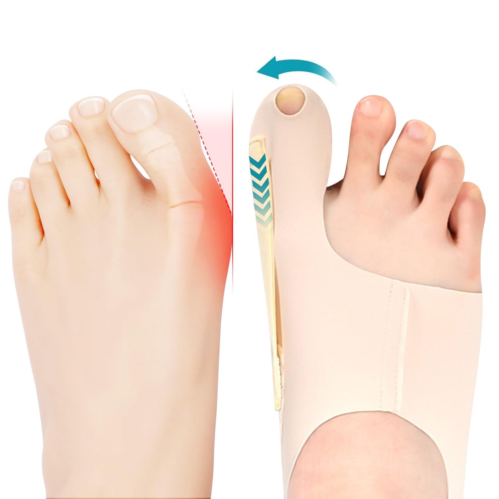 Корректор большого пальца стопы Epitact, ультратонкий, для мужчин и женщин, фото №1