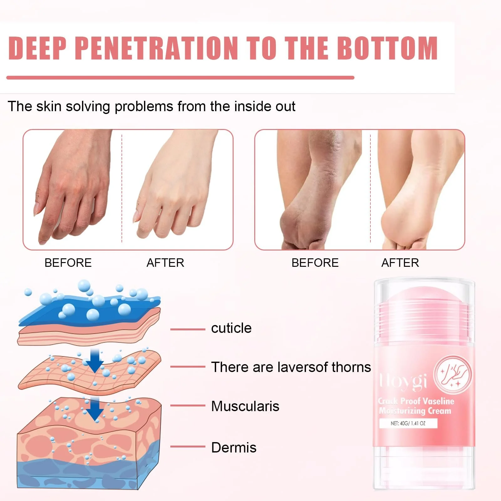 Крем для ног от мозолей и трещин с 60% мочевины и алоэ вера, фото №6 Крем для ног от мозолей и трещин с 60% мочевины и алоэ вера, фото №6