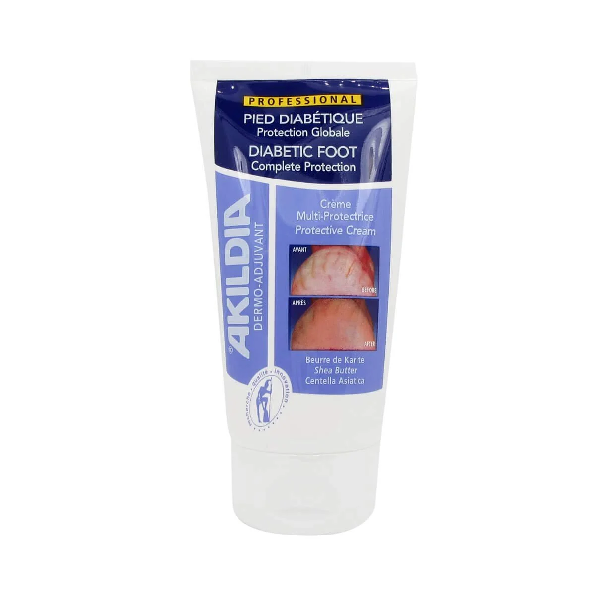 Защитный крем для ног Akildia Diabetic Foot Protector 150 мл, фото №1