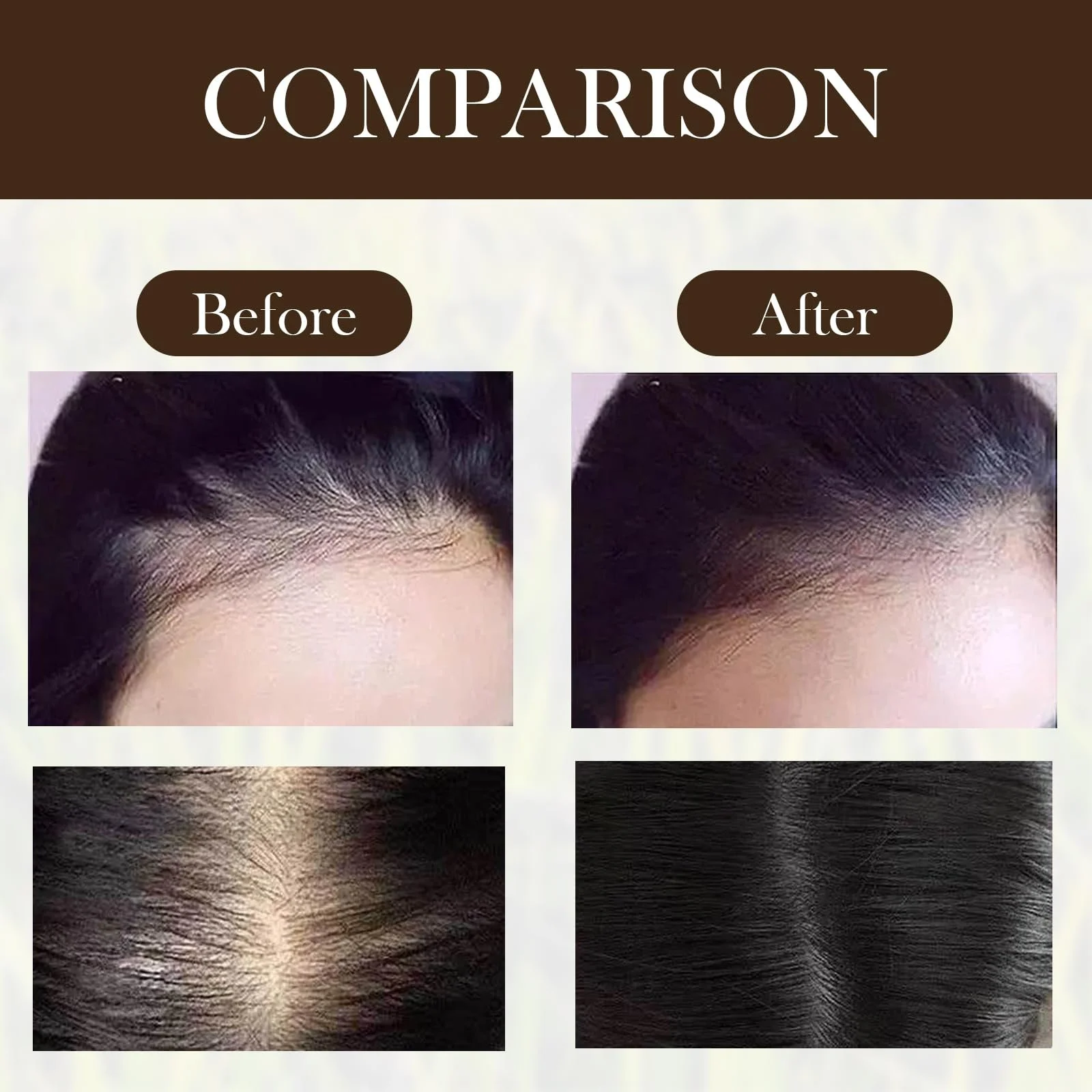 Спрей для росту волосся з водою з чорного рису 60 мл, фото №7 Спрей для росту волосся з водою з чорного рису 60 мл, фото №7