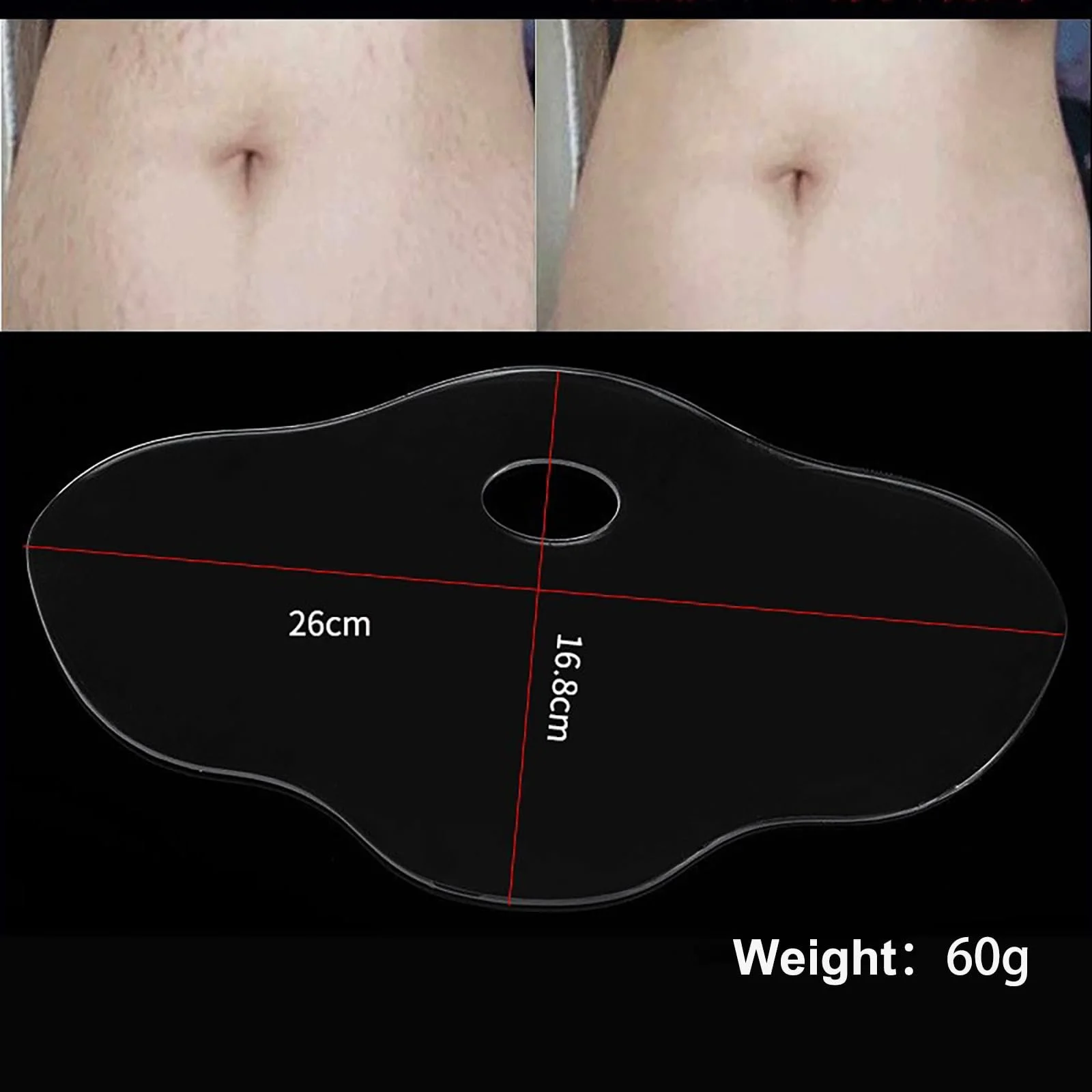 Пластир проти зморшок MKNZOME, 1 шт, Силіконовий для зменшення зморшок шкіри, фото №5