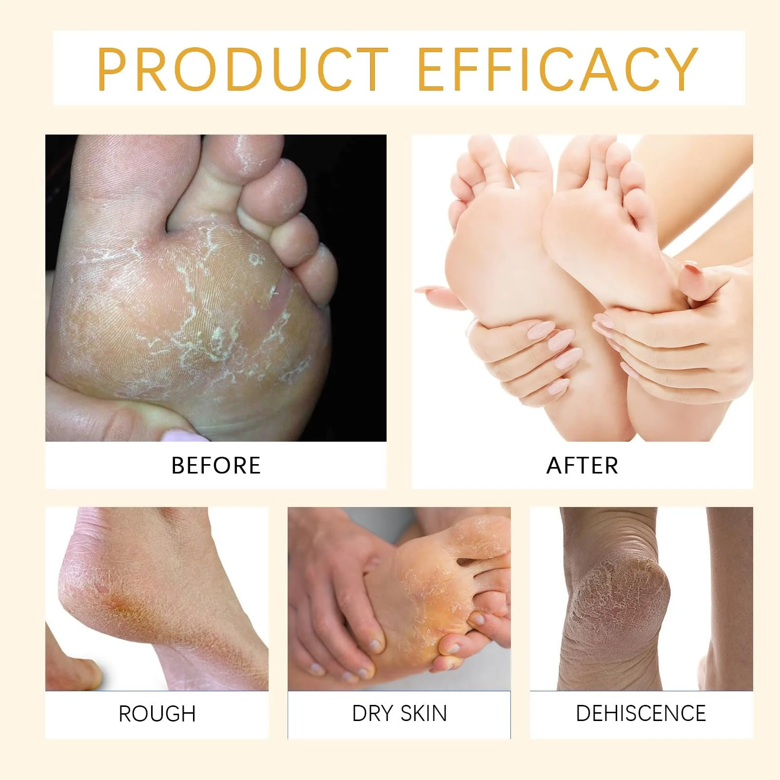 Крем для ног Urea 60% увлажняющий с алоэ вера 2 шт., фото №7 Крем для ног Urea 60% увлажняющий с алоэ вера 2 шт., фото №7