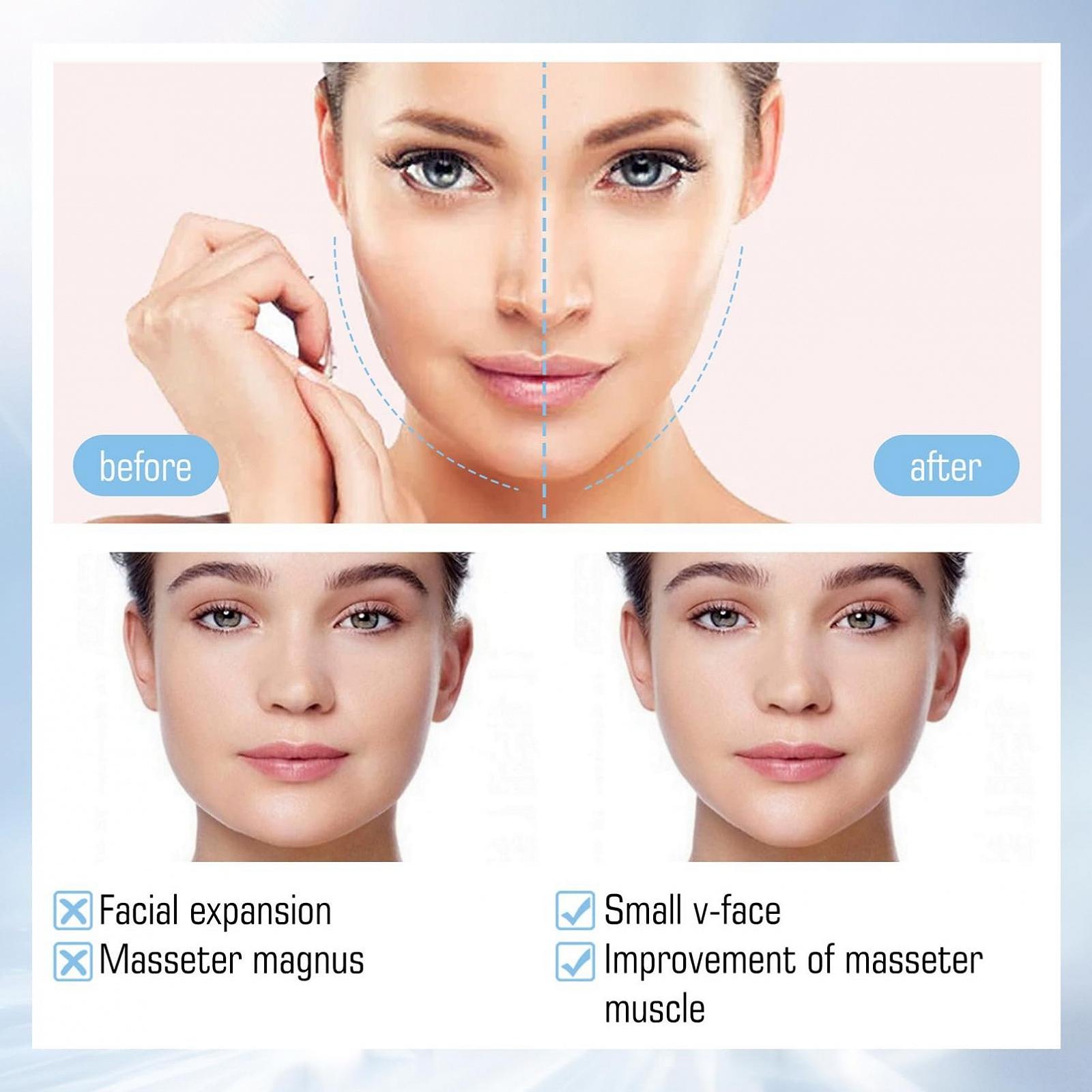 Маска для обличчя V-Line гіалуронова та набір патчів від зморшок, фото №5