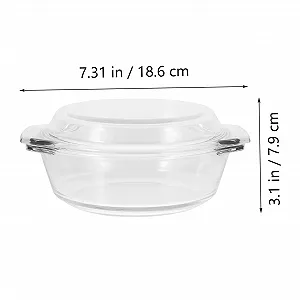 Форма для запікання Sosoport скляна термостійка з кришкою прозора synthetic.ua - Фото 1