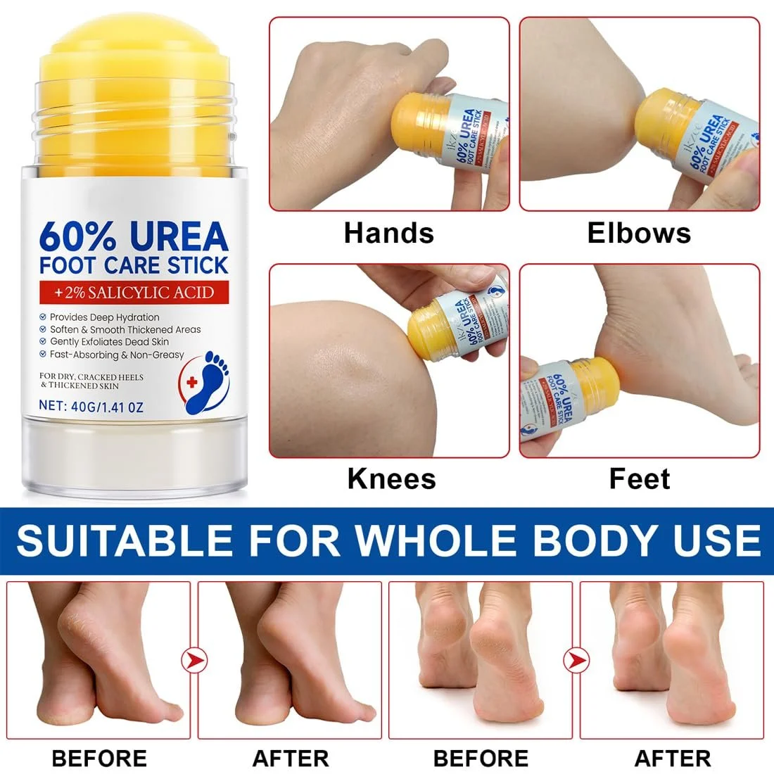 Крем для ног Urea Cream 60%, 2 шт., фото №6 Крем для ног Urea Cream 60%, 2 шт., фото №6