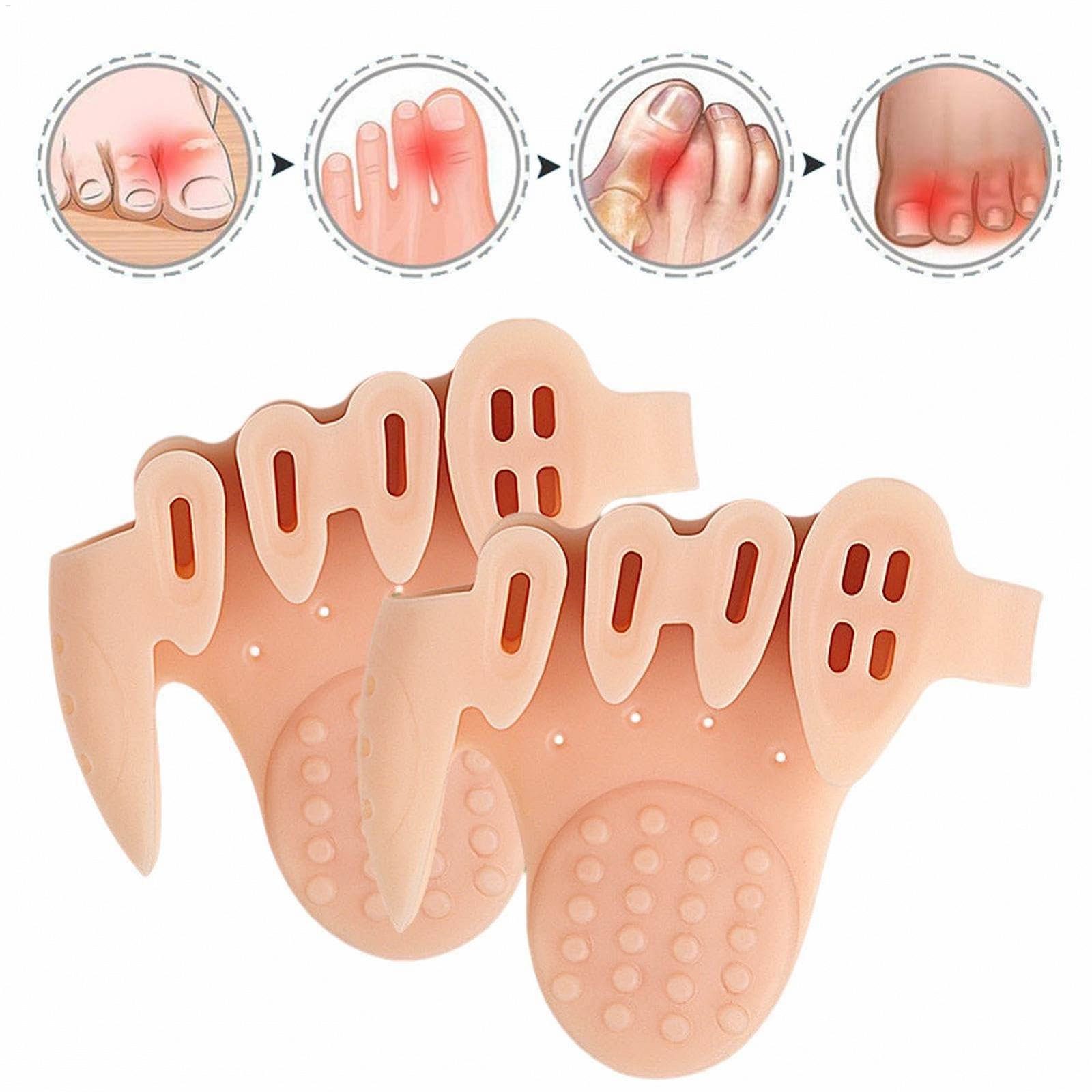 Разделитель для пальцев ног ортопедический, пять отверстий, толстый, массаж свода стопы, полуразмер, ортопедическая повязка, ортопедический рукав, корректор, фото №8