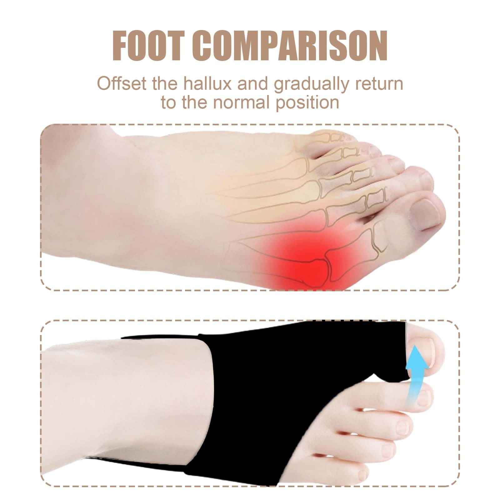 Пов'язка Hallux Valgus 3 пари, роздільники для пальців ніг, шина, фото №2