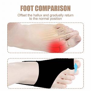 Пов'язка Hallux Valgus 3 пари, роздільники для пальців ніг, шина synthetic.ua - Фото 1