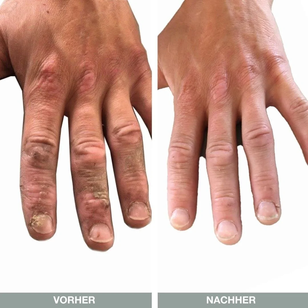 Крем для рук Australian Bodycare 100 мл Чайне дерево та Лимонний мирт, фото №5