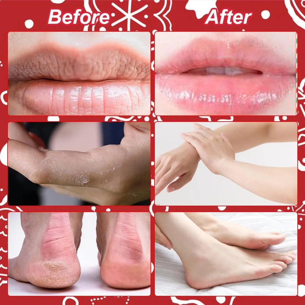 Крем для рук, набір: 2 креми для рук, 2 бальзами для губ, 2 креми для потрісканих ніг, фото №3