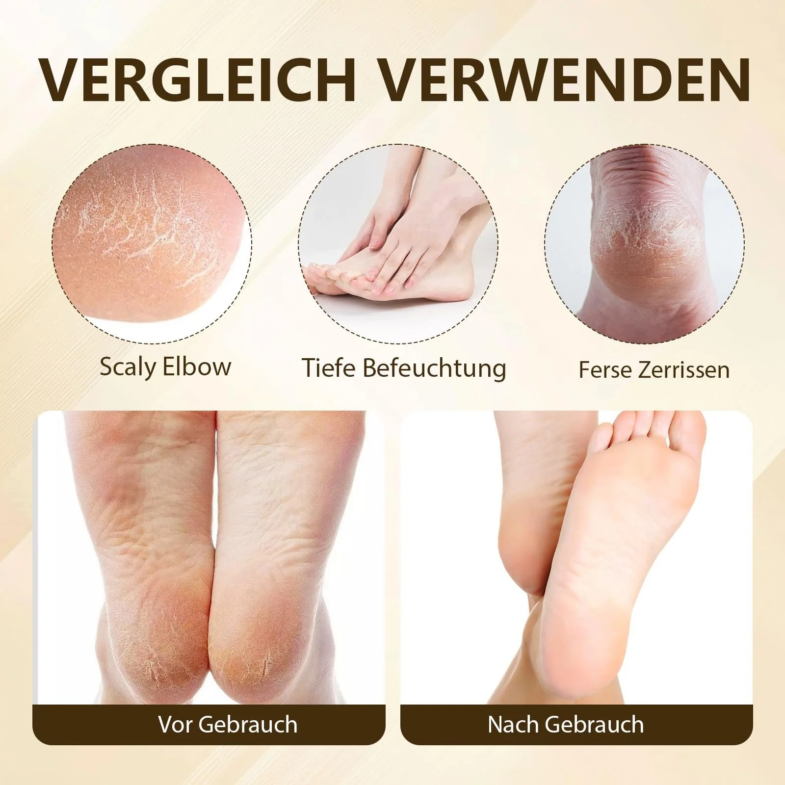 Крем для ног Urea Cream Intensive 60% для очень сухой кожи и потрескавшихся пяток 100 г, фото №5