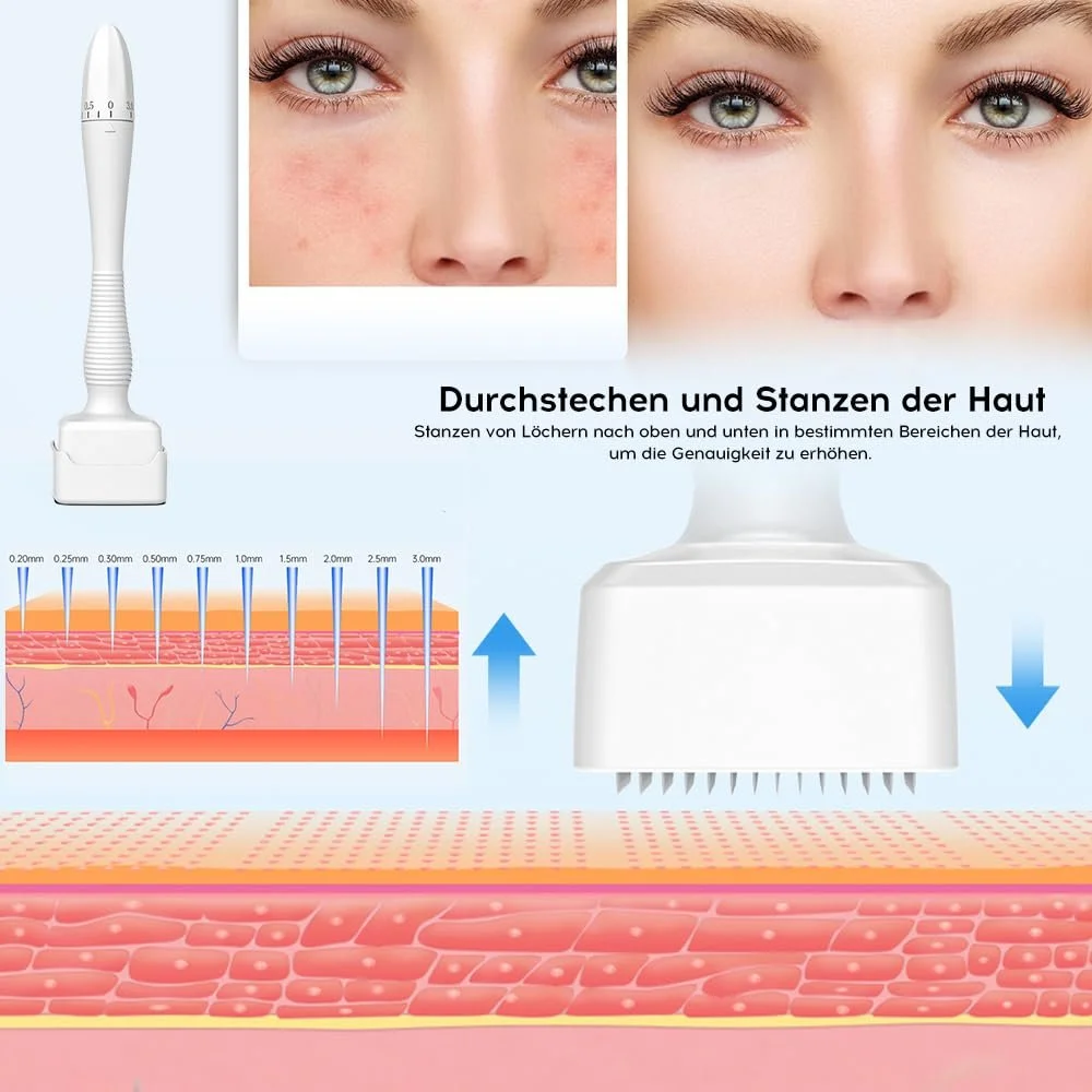 Дерма-штамп Регульований, 140 титанових мікроголок для волосся, бороди, обличчя та тіла, фото №1