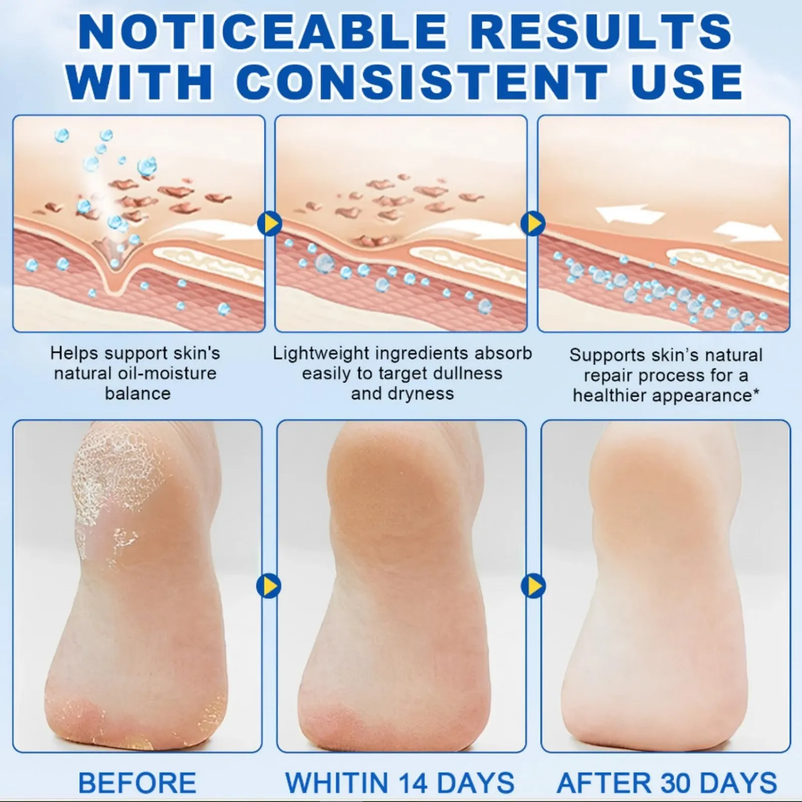 Крем Urea Cream 60% Callus Remover увлажняющий против трещин, фото №6 Крем Urea Cream 60% Callus Remover увлажняющий против трещин, фото №6