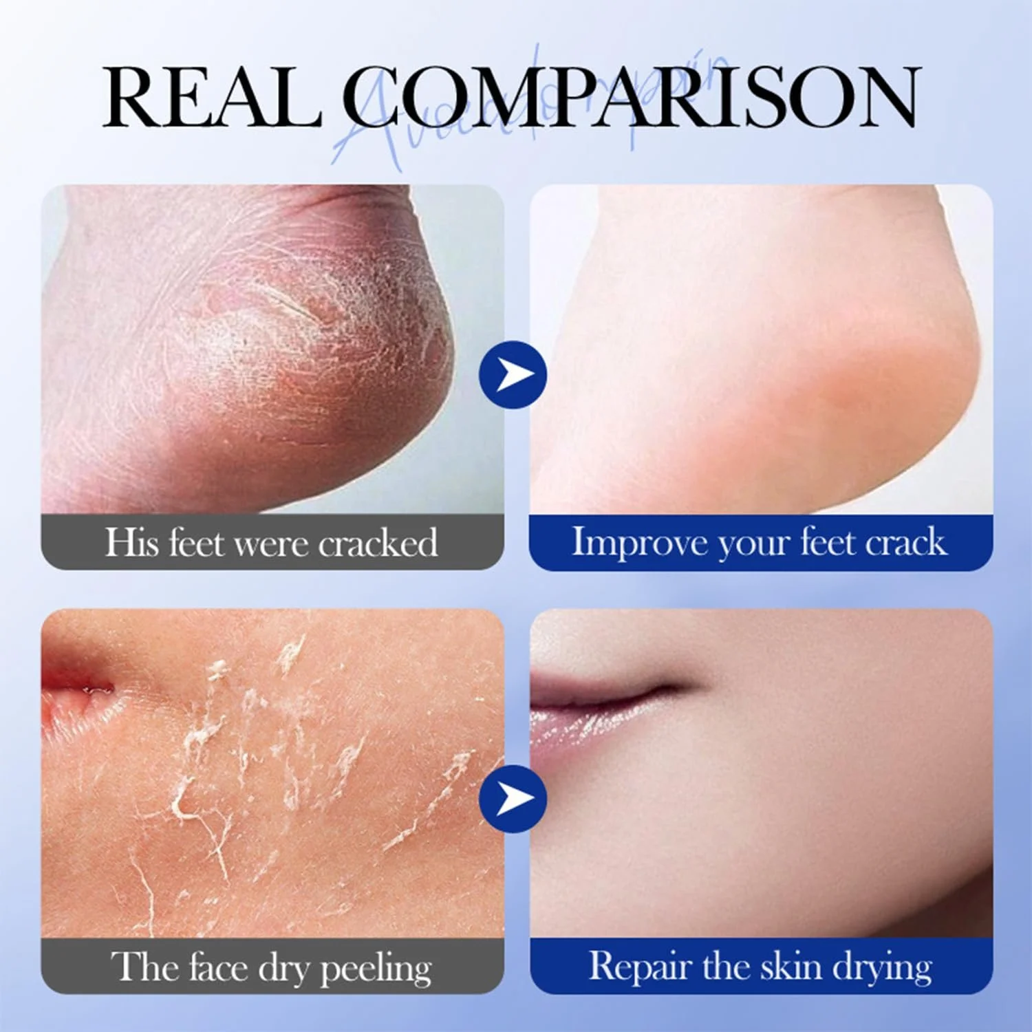 Крем-стик для ног Avocado увлажняющий против трещин для сухой кожи и пяток 40 г, фото №4