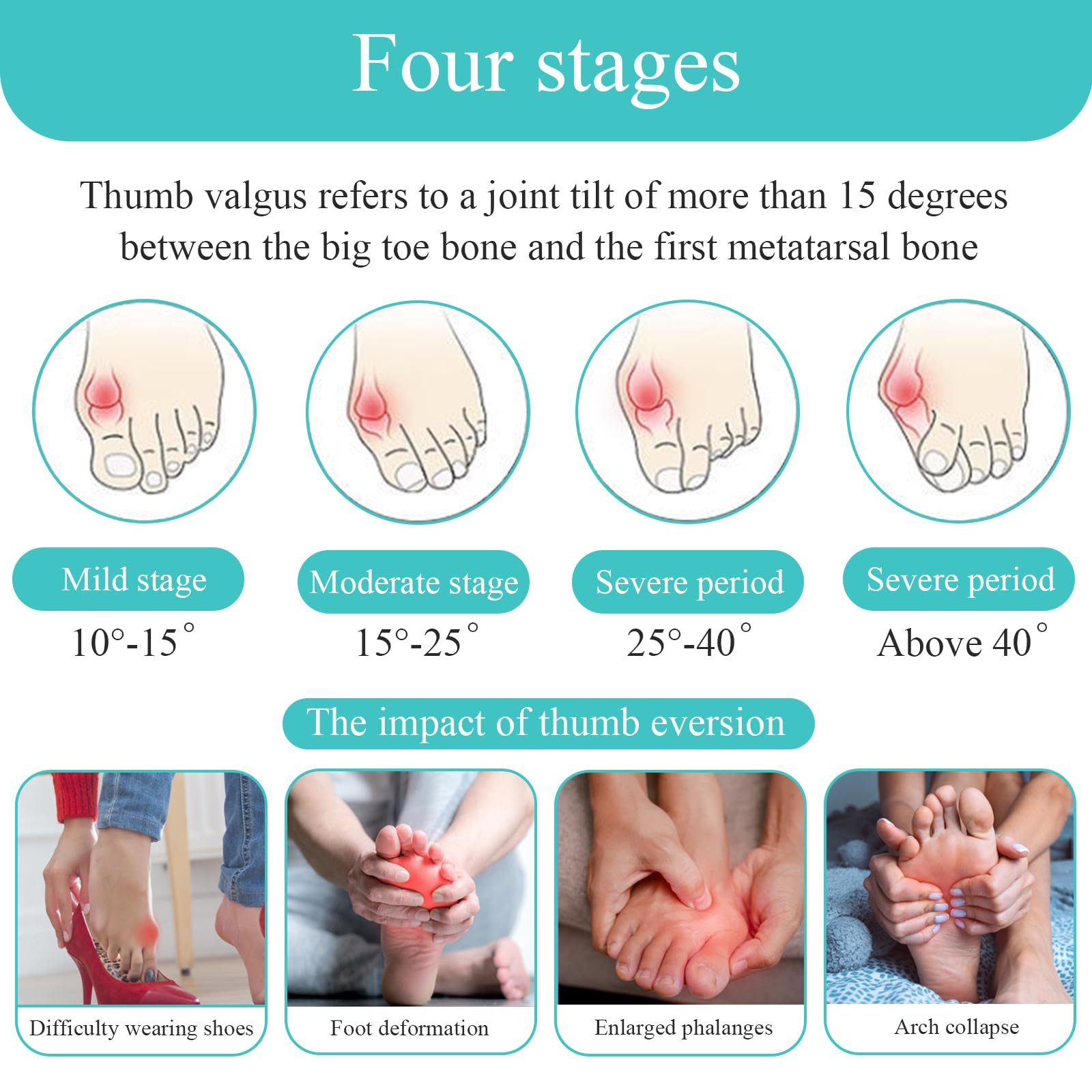Шкарпетки Hallux Valgus 2 шт., Коректор, фото №2