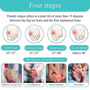 Шкарпетки Hallux Valgus 2 шт., Коректор synthetic.ua - Фото 1