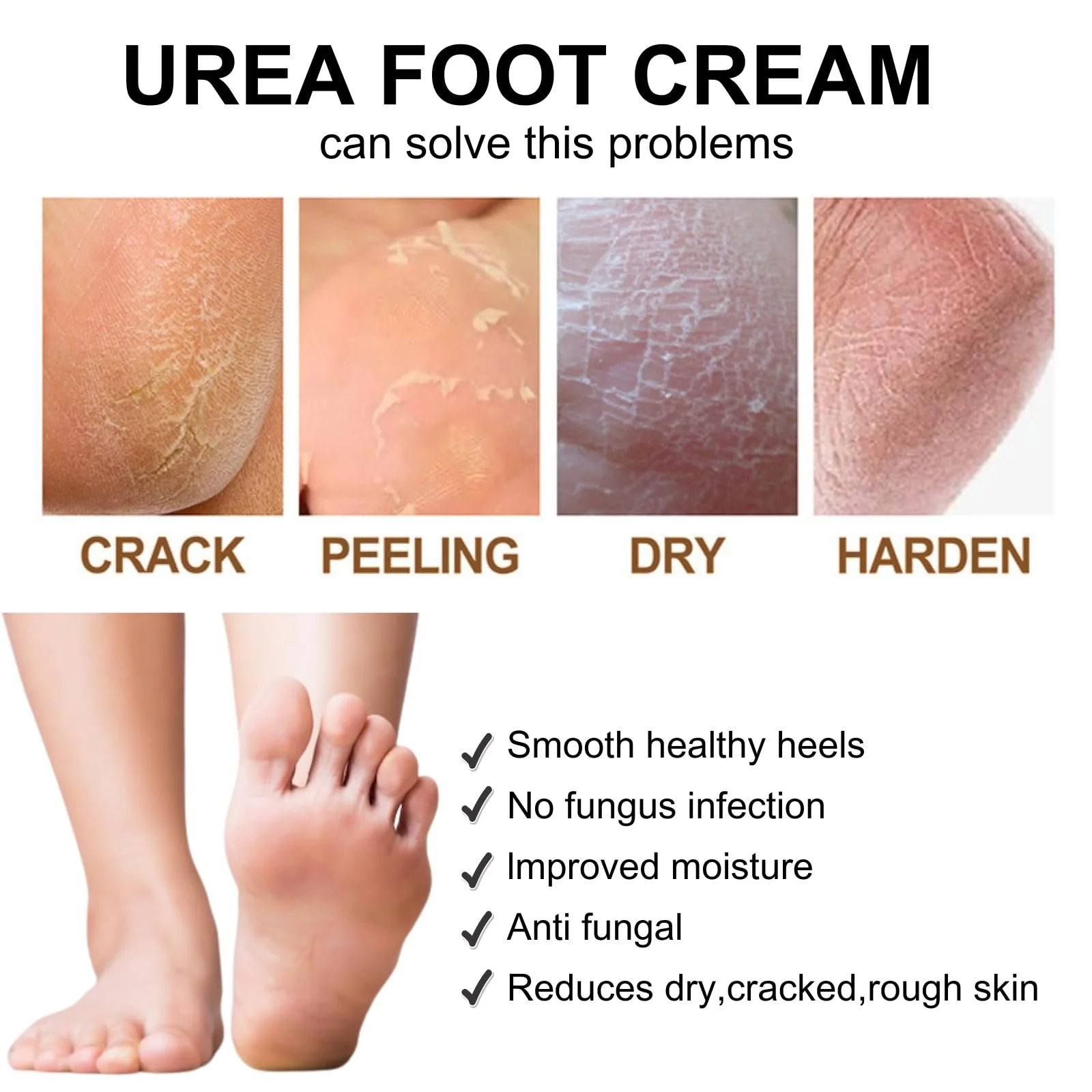 Крем для ног, рук и тела Urea Cream 40% сечовины для удаления мозолей и увлажнения, 150 г, фото №7