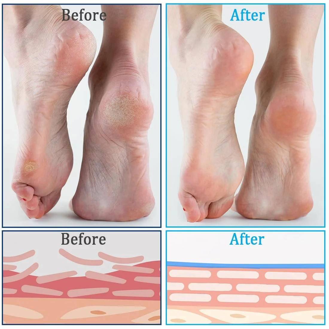 Крем-стик для ног Urea Cream 60% Urea и 2% Salicylic Acid увлажняющий от мозолей 40 г, фото №5