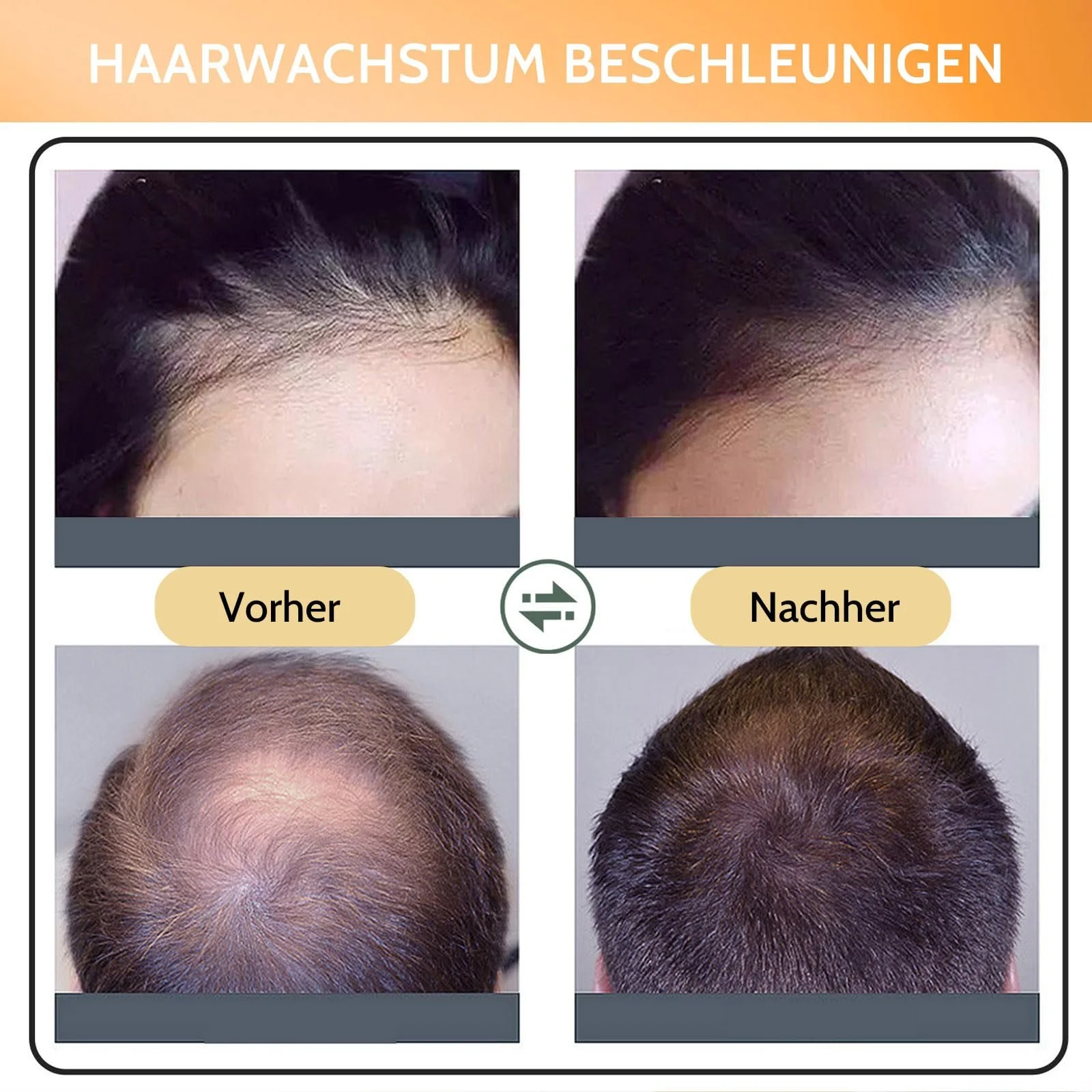 Спрей для росту волосся Shefave для здоровішого, густішого, гладкого волосся, фото №6