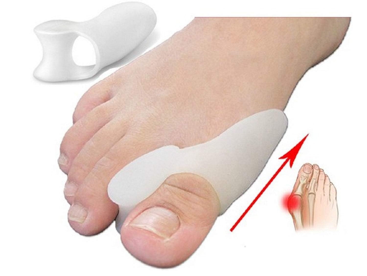 Набір роздільників для пальців ніг Hallux Valgus 12 шт. Шина, фото №7