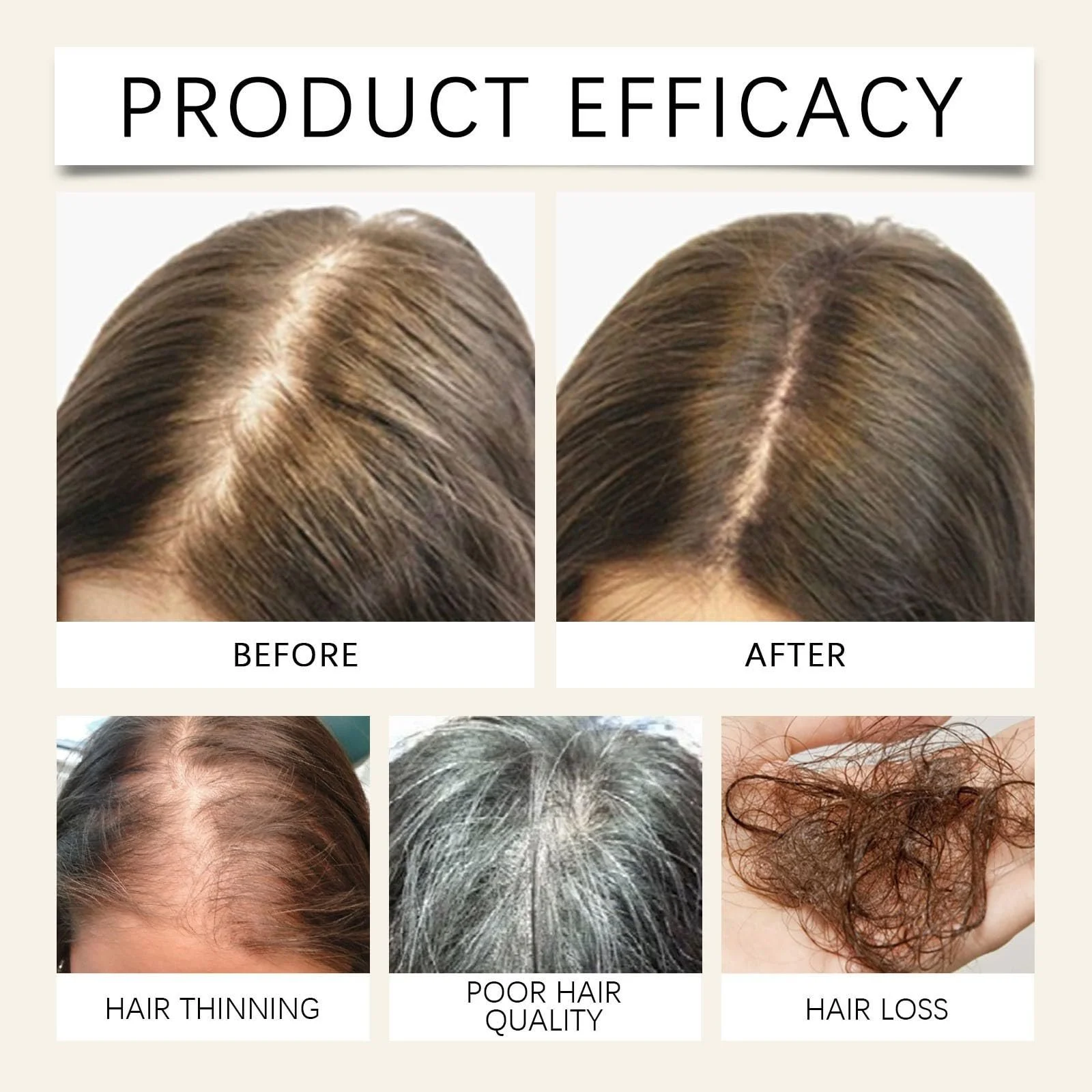 Капсули для росту волосся з імбиром, капсули для відновлення волосся, фото №3