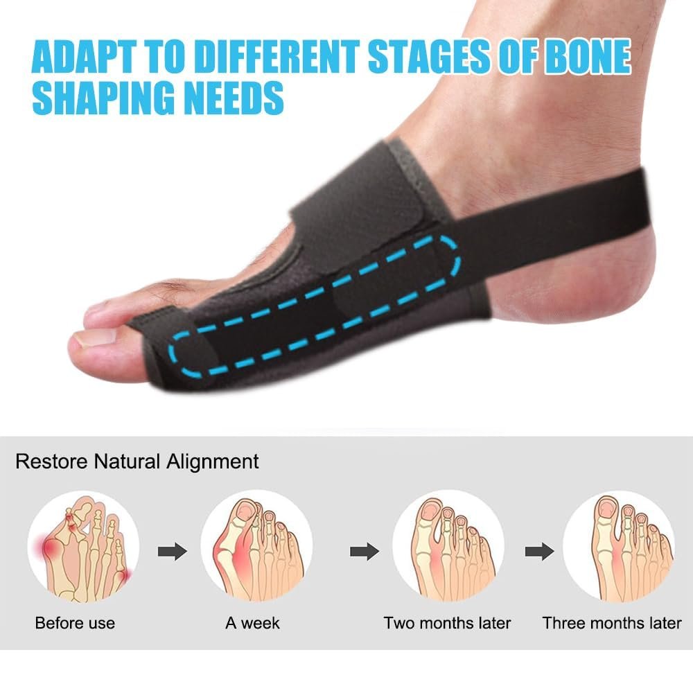 Шина для корекції великого пальця стопи Hallux Valgus Регульована Універсальний розмір для чоловіків і жінок, 1 пара, фото №4
