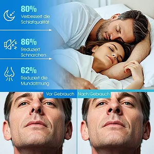 Магнітні назальні пластирі Стартовий набір (30 днів) synthetic.ua - Фото 1