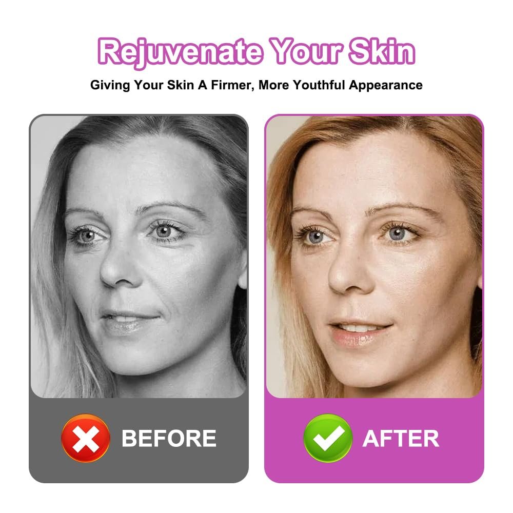 Тейп для обличчя ліфтинговий, 4 шт, 2.5 см x 5 м, 4 кольори, для підтяжки та зміцнення шкіри, фото №4