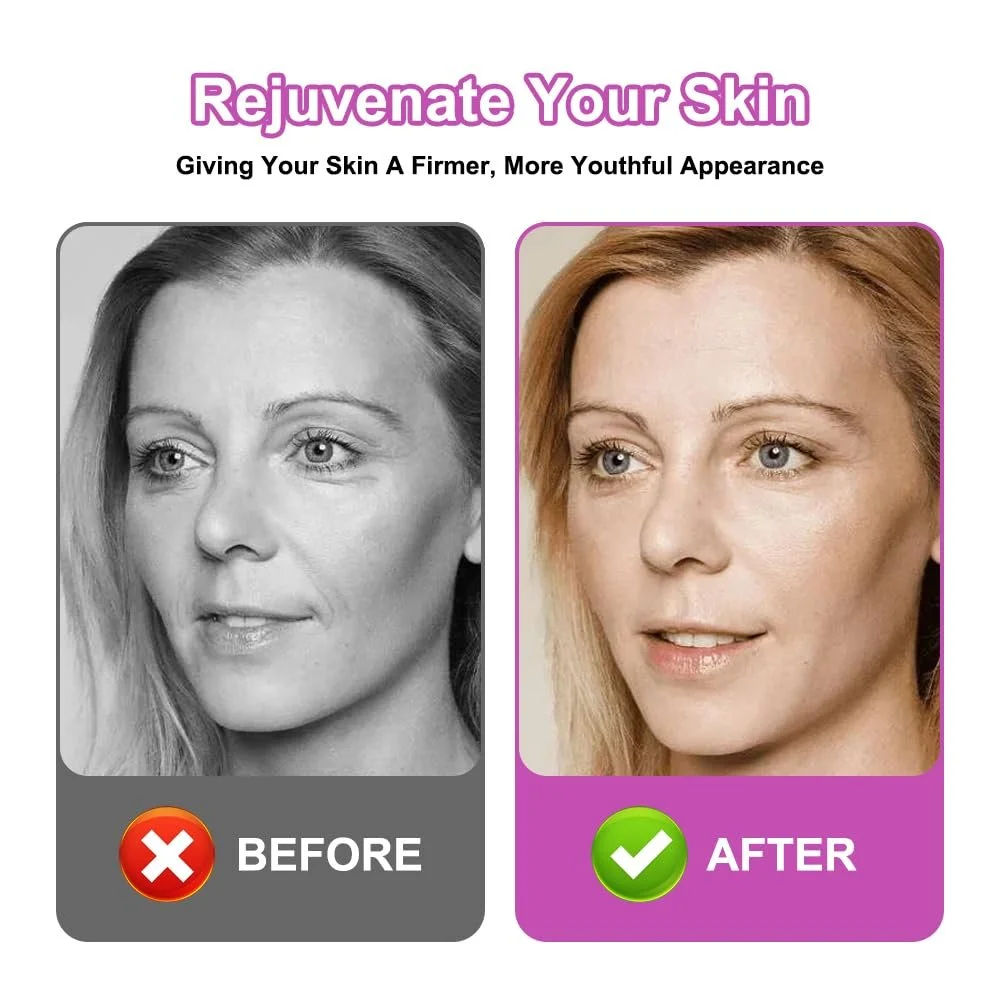 Тейп для обличчя ліфтинговий, 4 шт, 2.5 см x 5 м, 4 кольори, для підтяжки та зміцнення шкіри, фото №4