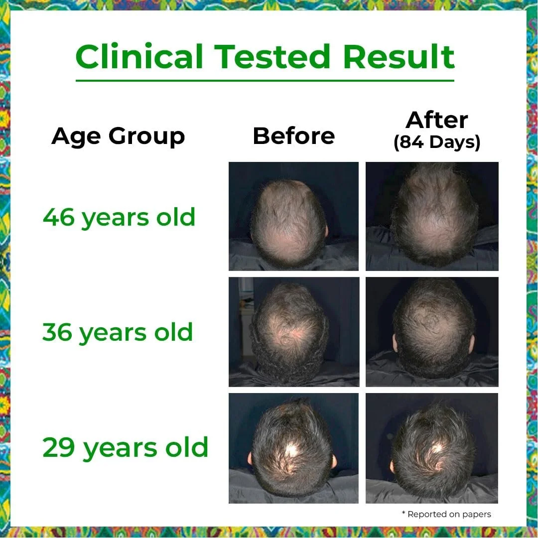 Сироватка для росту волосся Passion Indulge Advanced Для чоловіків і жінок - 50 мл, фото №3