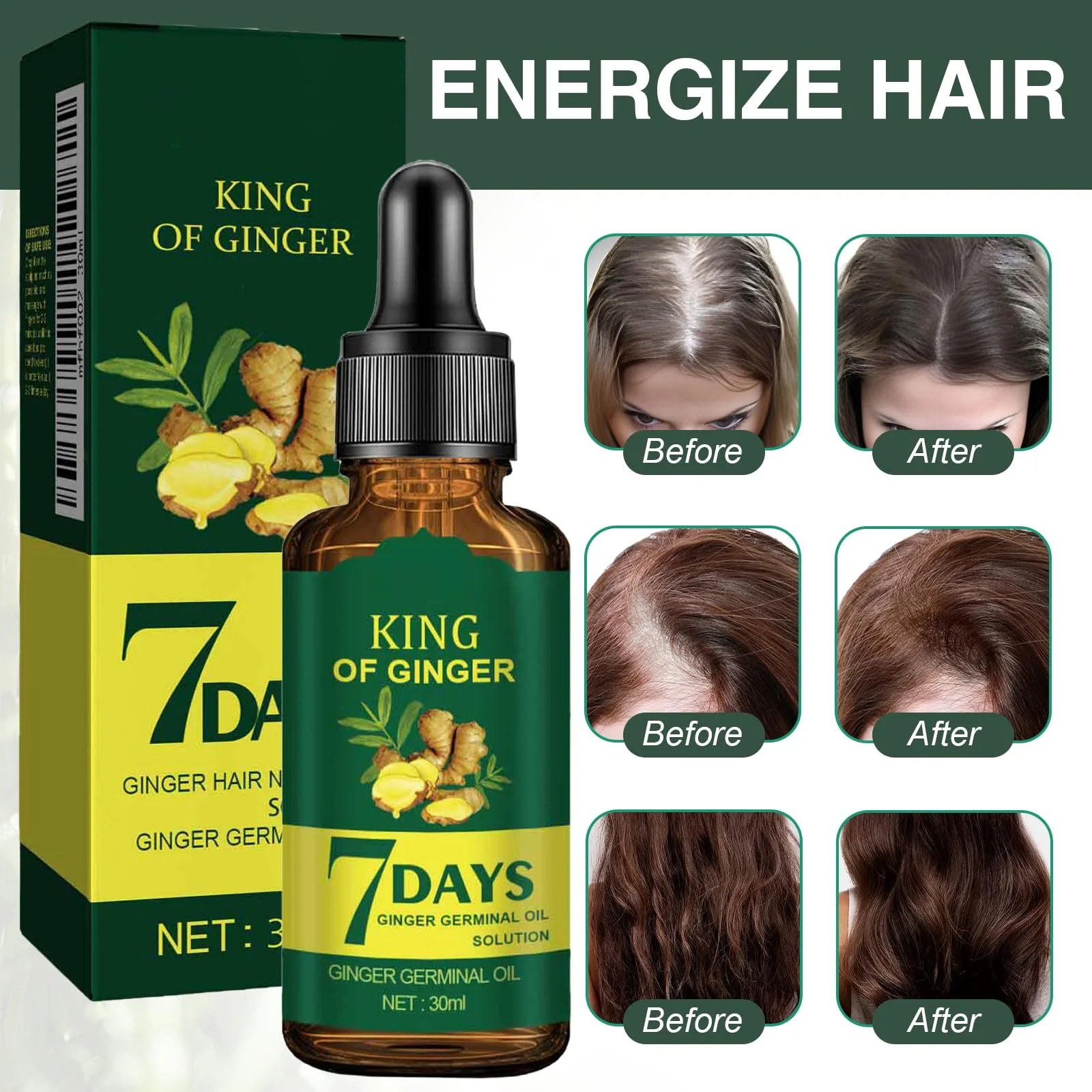 Олія для росту волосся Thoquene Імбирна, 2 шт, фото №4