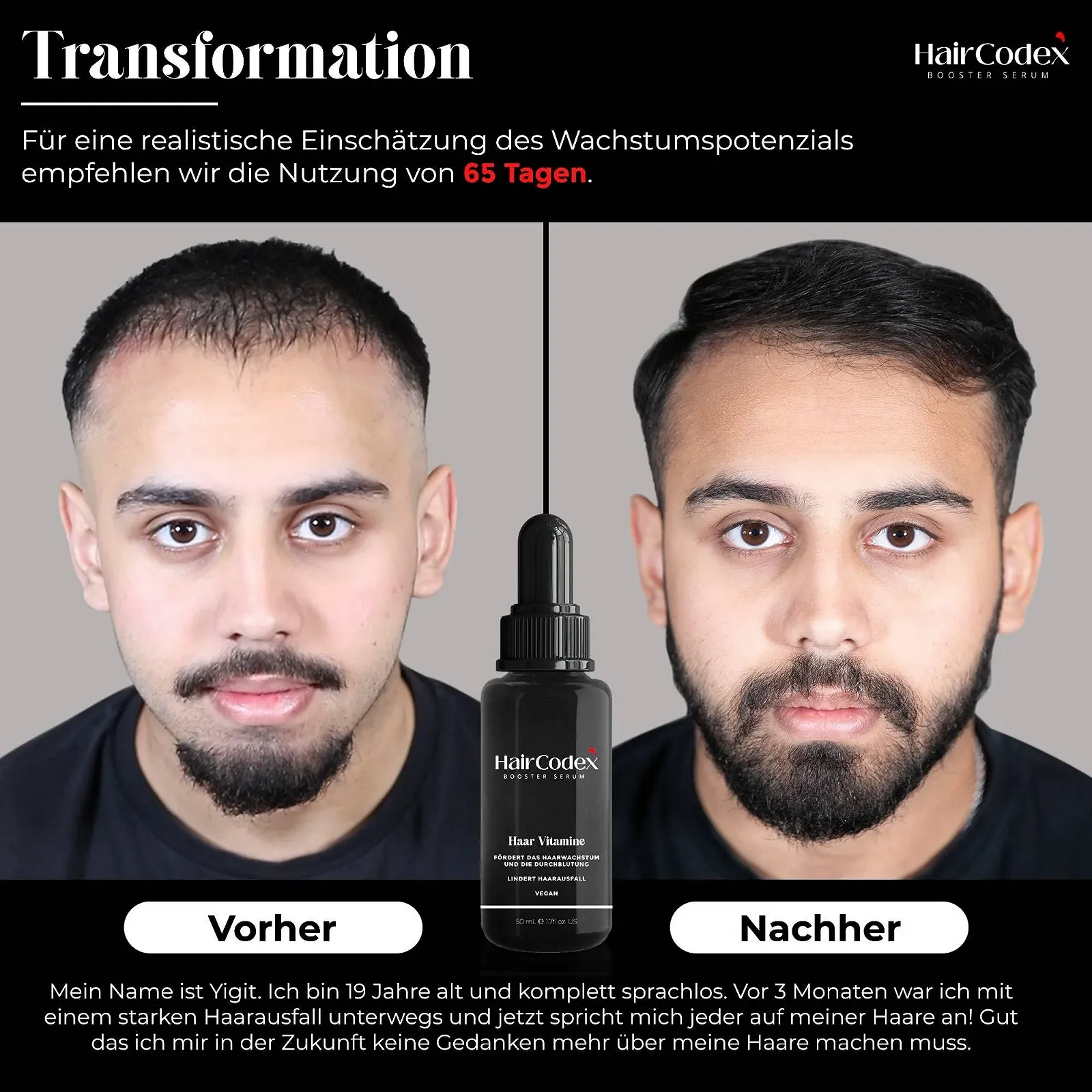 Сироватка-бустер HairCodex 50 мл, Агент для росту волосся, фото №4