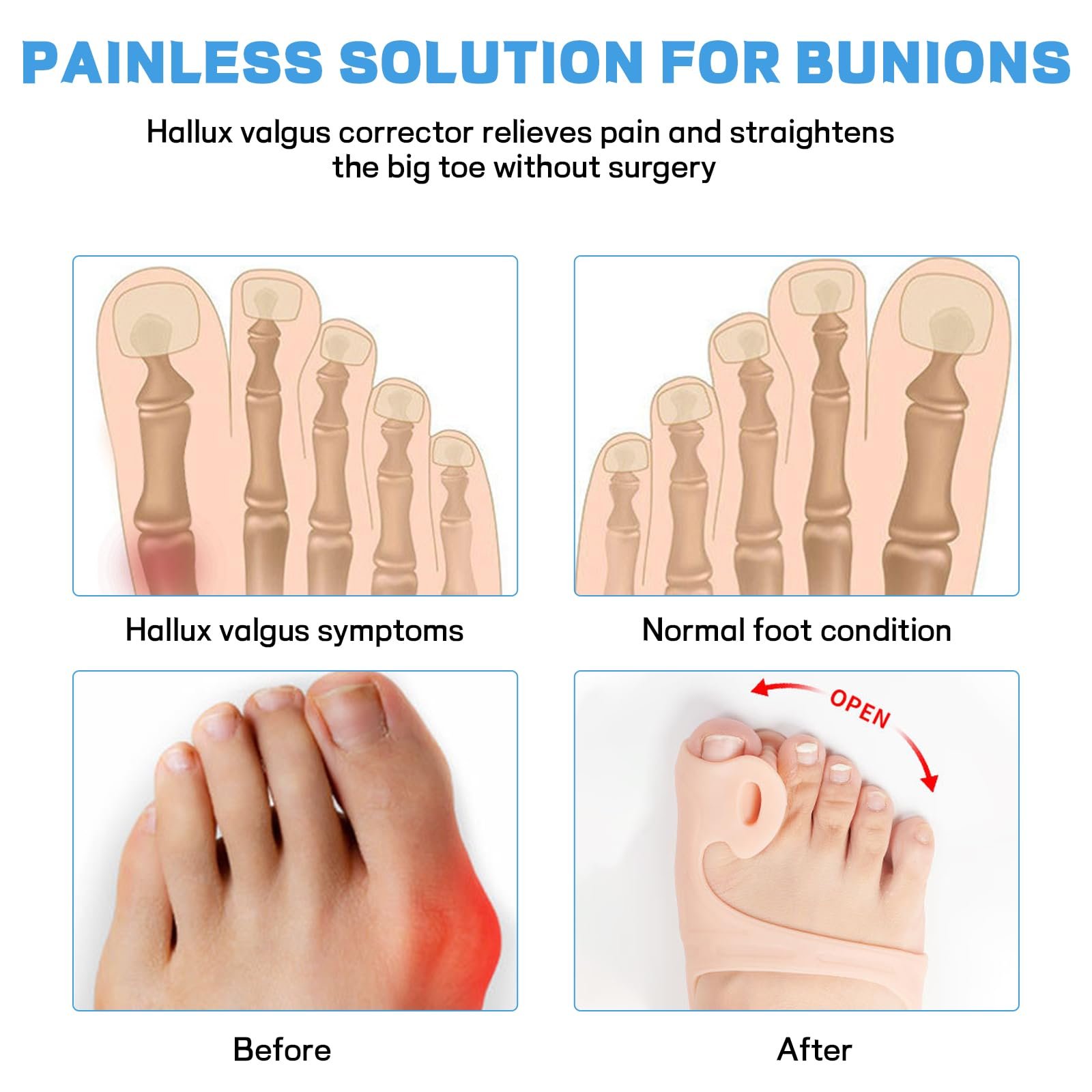 Роздільник для пальців Hallux Valgus, 2 шт., шина Hallux Valgus, фото №4