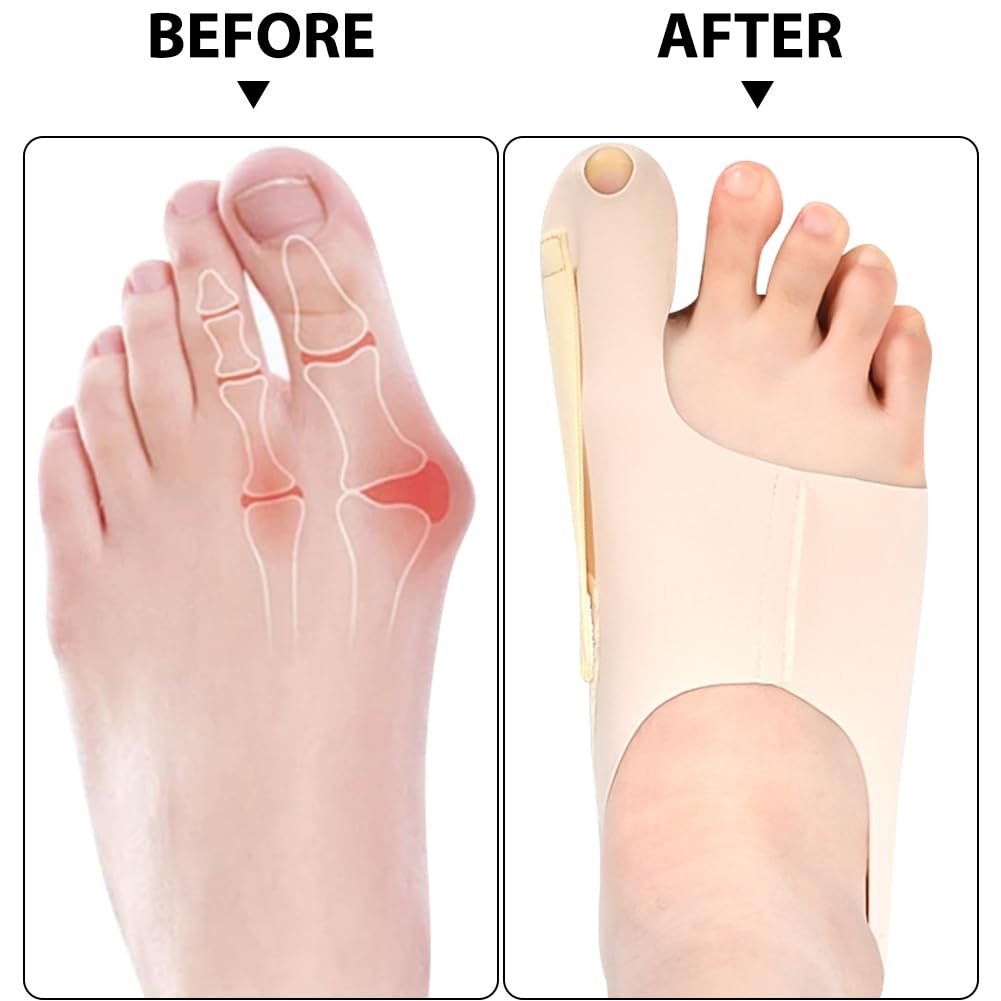 Коректор великого пальця стопи RANJIMA, 1 пара, фото №6