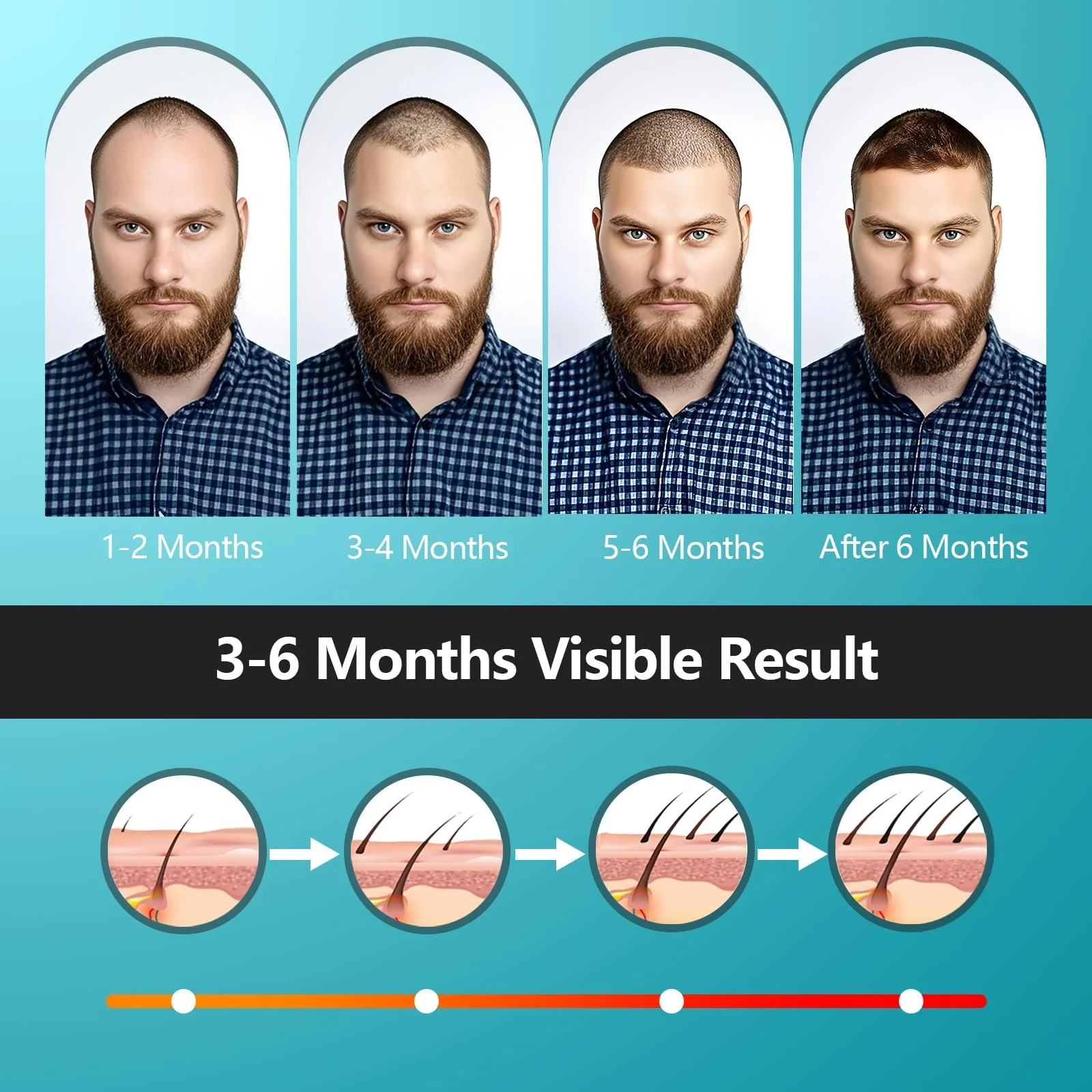 Кепка для росту волосся iKeener lllt Laser, 660 нм та 850 нм, червоне світло, фото №5