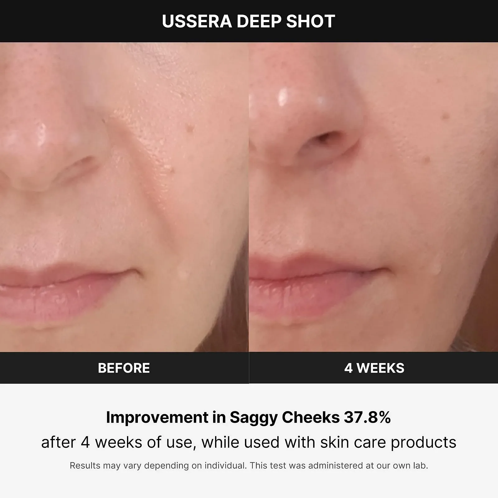Прилад для догляду за обличчям Medicube Age-R USSERA Deep Shot Korean Skin Care, фото №4