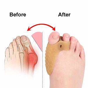 Разделитель для пальцев ног гелевый 4 шт/2 пары Разделители для пальцев ног Hallux Valgus Bunion Pads Шина synthetic.ua - Фото 1