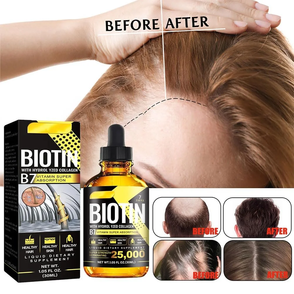 Сироватка для росту волосся, B7 Біотин, 30 мл, для жінок та чоловіків, проти випадіння, фото №7 Сироватка для росту волосся, B7 Біотин, 30 мл, для жінок та чоловіків, проти випадіння, фото №7