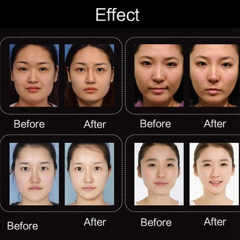 Маска для ліфтингу обличчя V-подібна гелева маска Пластир для підтяжки, фото №6