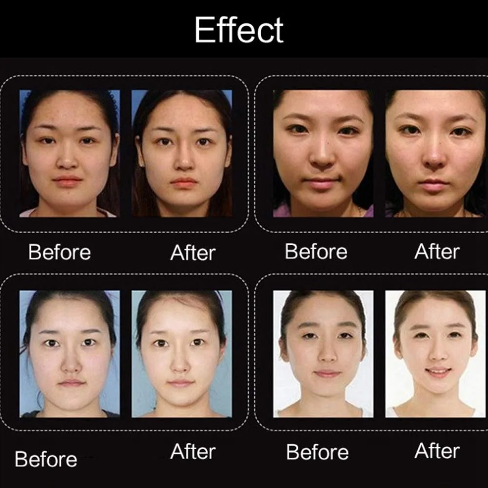 Маска для ліфтингу обличчя V-подібна гелева маска Пластир для підтяжки, фото №6