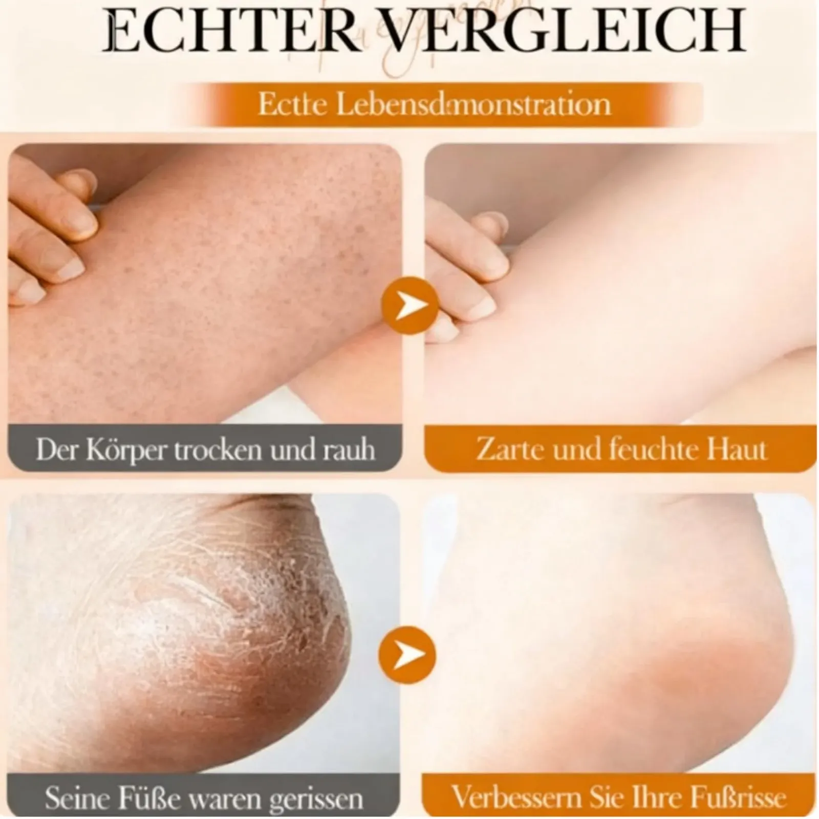 Крем-стик для ног Manuka Honey увлажняющий против трещин, фото №6 Крем-стик для ног Manuka Honey увлажняющий против трещин, фото №6