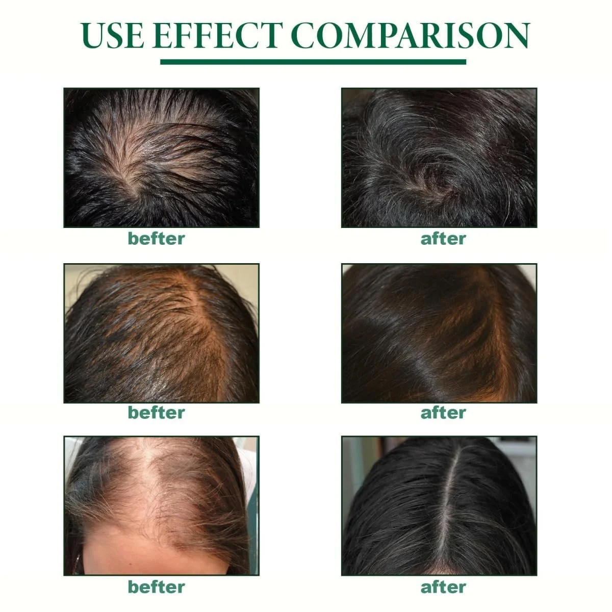 Сироватка для волосся Імбирна Інтенсивний догляд, фото №4