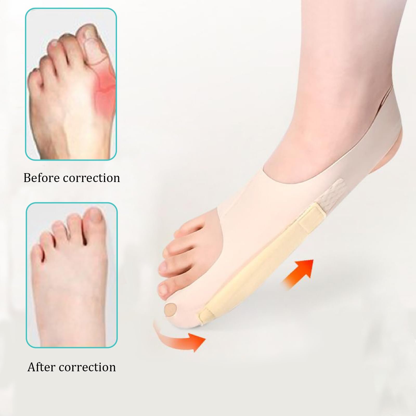 Шкарпетки Hallux Valgus 2 шт., Коректор, фото №5