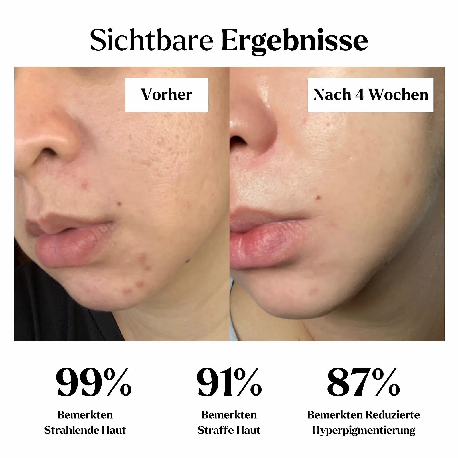 Набір глиняних масок для обличчя Green Tea Clay Mask для глибокого очищення та зменшення чорних цяток (4 x 100 г), фото №4