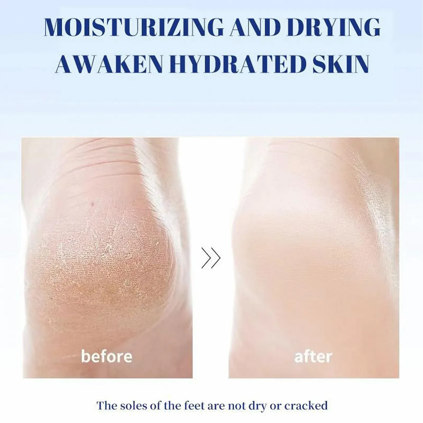 Бальзам для п'ят Живильний пом'якшувальний з масажним роликом 40 мл проти сухої та потрісканої шкіри, фото №7