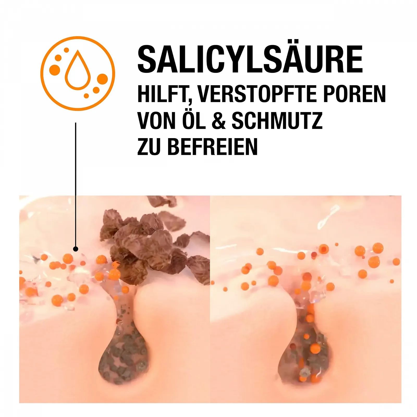 Гель для вмивання Neutrogena Anti-Pimple Щоденний з саліциловою кислотою для проблемної шкіри, без олій, 200 мл, фото №8 Гель для вмивання Neutrogena Anti-Pimple Щоденний з саліциловою кислотою для проблемної шкіри, без олій, 200 мл, фото №8