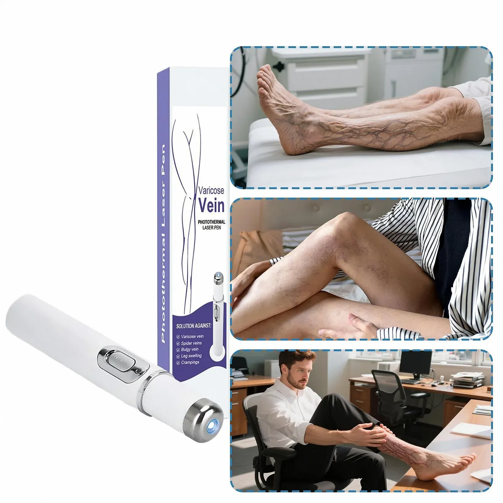 Олівець для видалення судинних зірочок Spider Vein Removal Pen бездротовий, фото №7