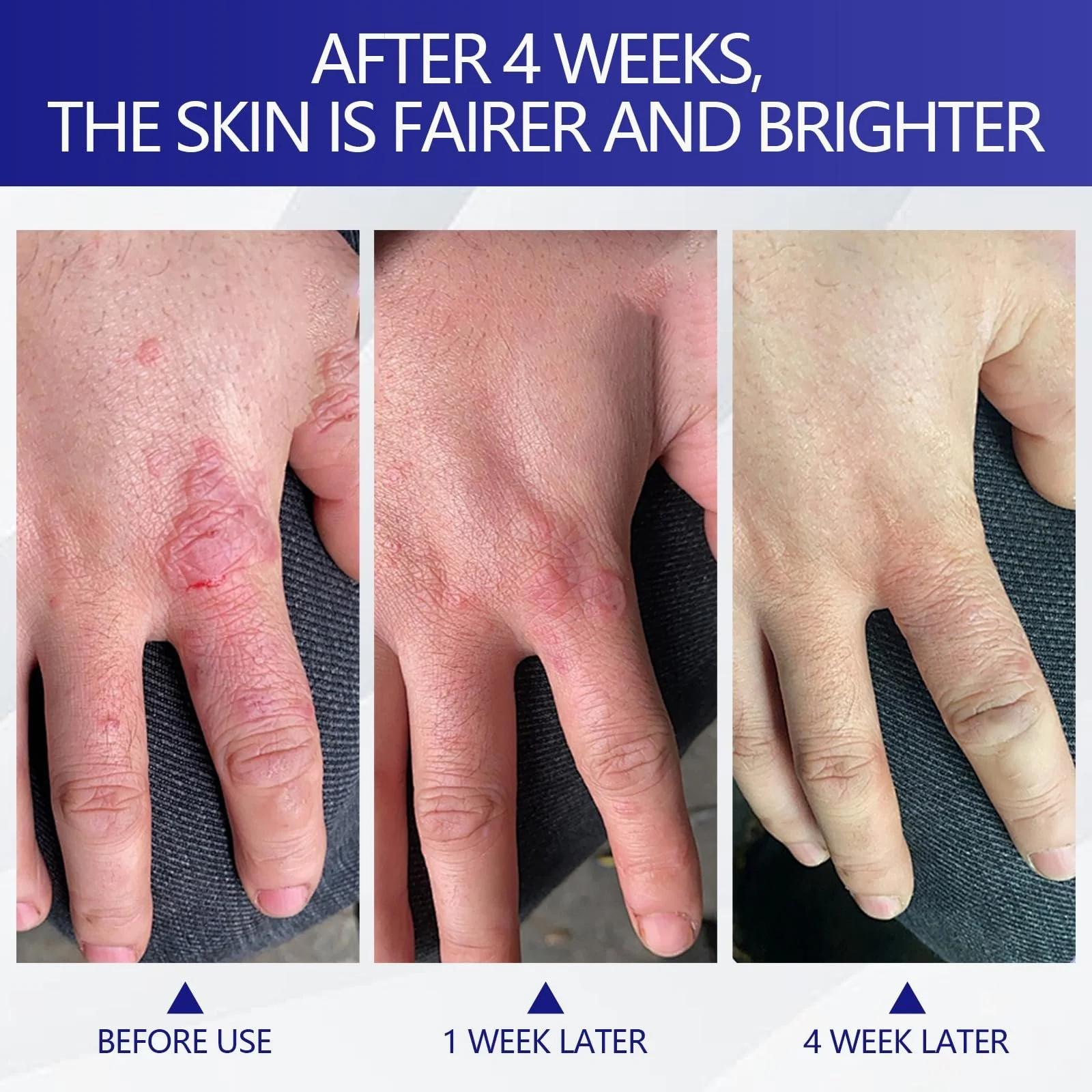 Крем для ухода за ногами Hydrating and Anti-Cracking увлажняющий, против трещин, 100 мл, фото №3 Крем для ухода за ногами Hydrating and Anti-Cracking увлажняющий, против трещин, 100 мл, фото №3